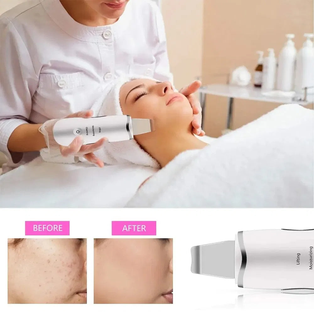 UltraSkin Tri-Function Pro - Advanced Ultrasonic Facial Spatula System